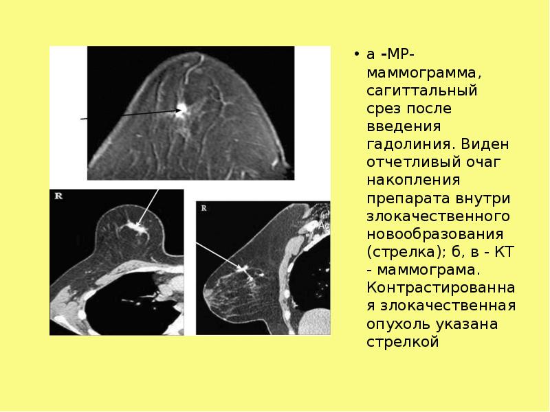 Центр маммограммы