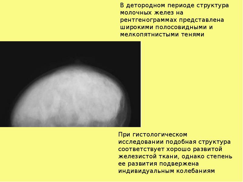 Презентация молочная железа