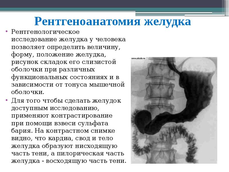 Рентген с барием пищевода и желудка подготовка. Рентгенологическое исследование ЖКТ. Рентгеноконтрастное исследование желудка. Рентгеноанатомия желудка.