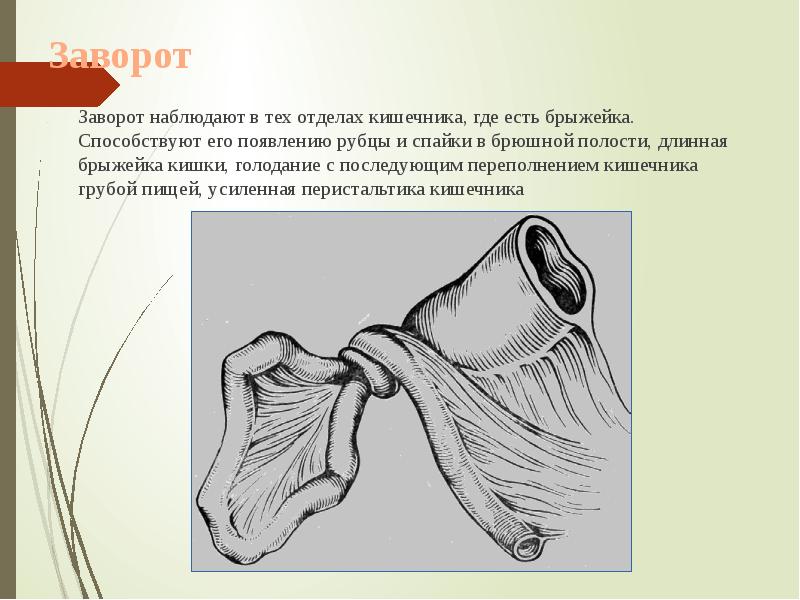 Заворот
Заворот наблюдают в тех отделах кишечника, Заворот
Заворот наблюдают в тех отделах кишечника,