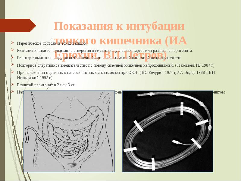 Показания к интубации тонкого кишечника (ИА Ерюхин, ВП Петров)
Паретическое состояние тонкой Показания к интубации тонкого кишечника (ИА Ерюхин, ВП Петров)
Паретическое состояние тонкой