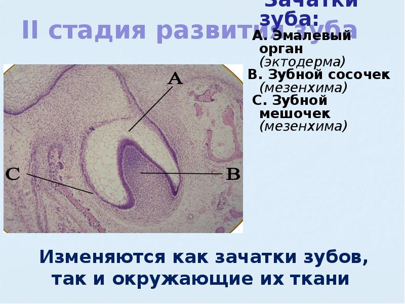 Зубной зачаток схема