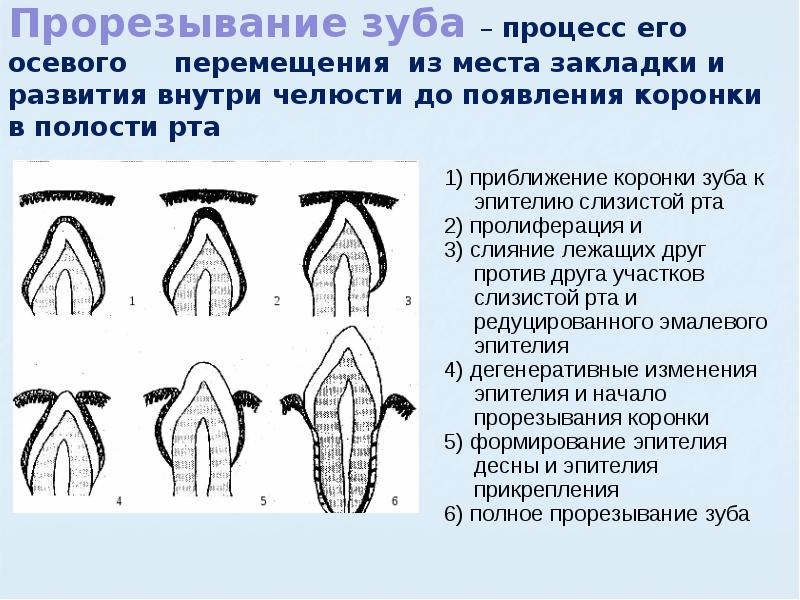 Прорезывание зубов карта вызова