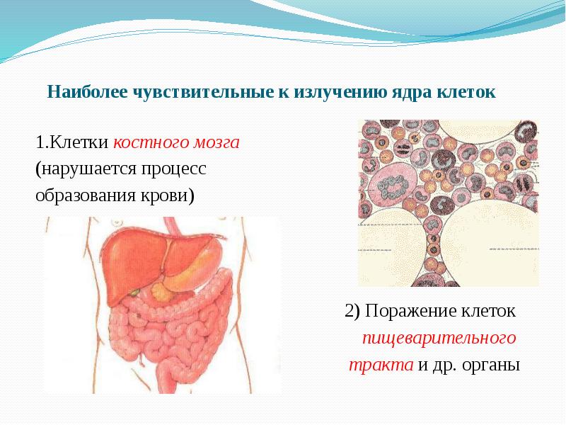 Наиболее чувствительны. Наиболее чувствительные к радиации клетки. Радиация воздействие на костный мозга. Наиболее устойчивы к радиации костный мозг. Системы клетки наиболее чувствительные к повреждению.