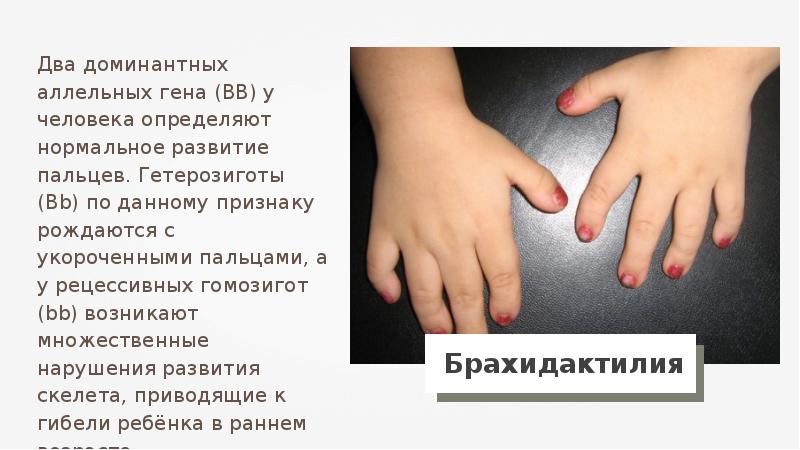 рецессивный аллель гена. доминантный аллельный ген. множественный аллелизм окраска кроликов. полное доминирование генетика. доминантный аллель это.