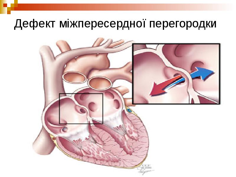 Овальное окно фото у ребенка