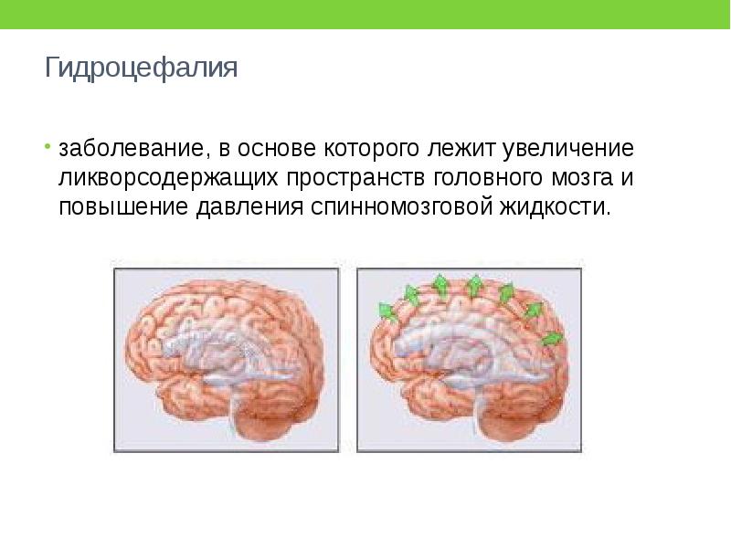 Заболевания половой системы презентация