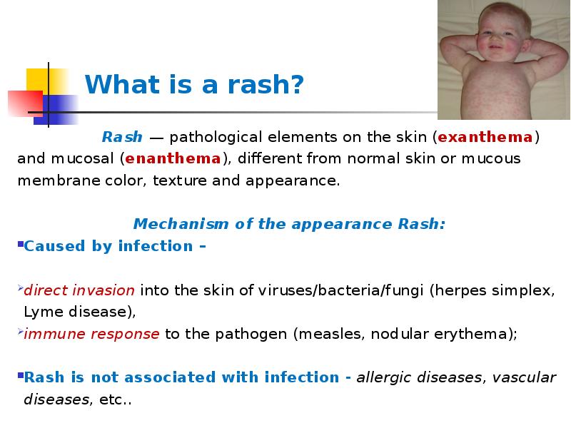 What is a rash?
What is a rash?