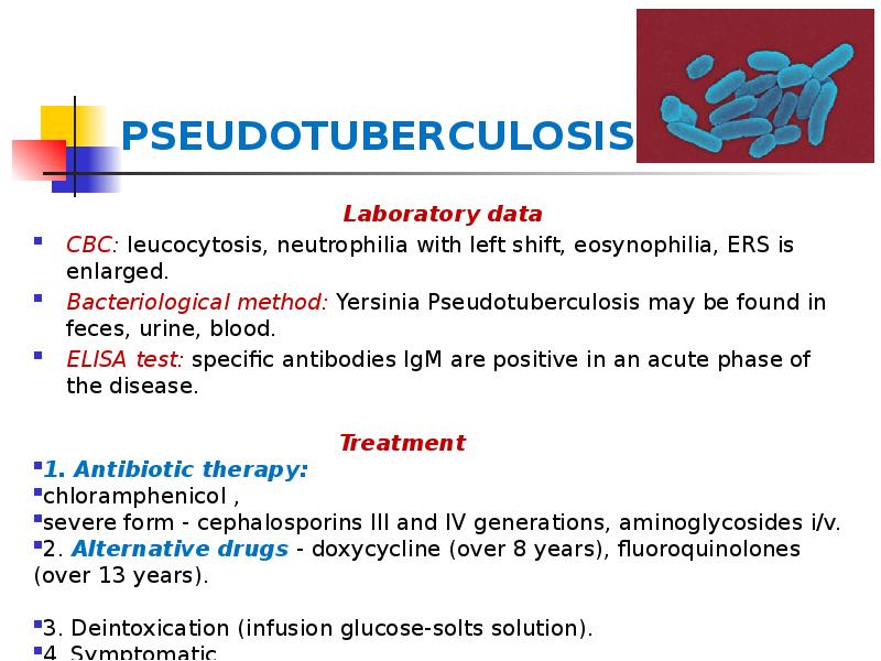 PSEUDOTUBERCULOSIS
Laboratory data
CBC: leucocytosis, neutrophilia with left shift, eosynophilia, ERS PSEUDOTUBERCULOSIS
Laboratory data
CBC: leucocytosis, neutrophilia with left shift, eosynophilia, ERS