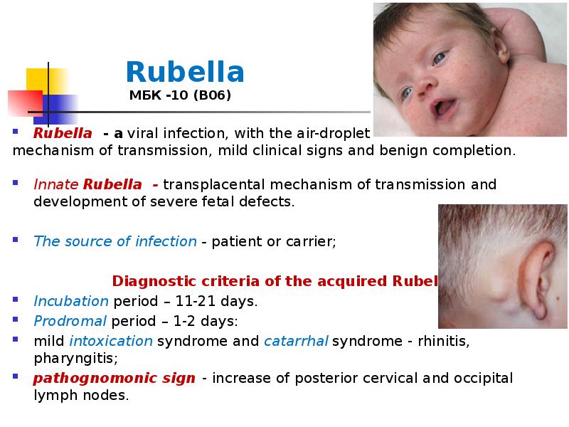 Rubella МБК -10 (В06)
Rubella - a viral infection, with Rubella МБК -10 (В06)
Rubella - a viral infection, with