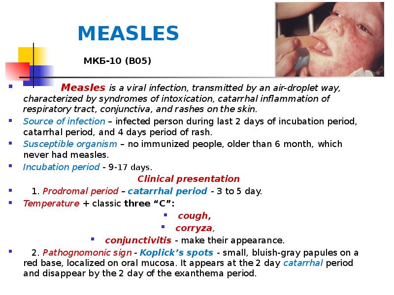 MEASLES МКБ-10 (В05)
MEASLES МКБ-10 (В05)