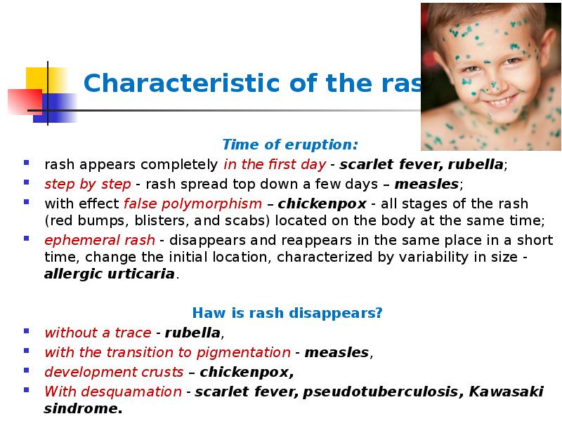 Characteristic of the rash
Time of eruption:
rash appears completely Characteristic of the rash
Time of eruption:
rash appears completely