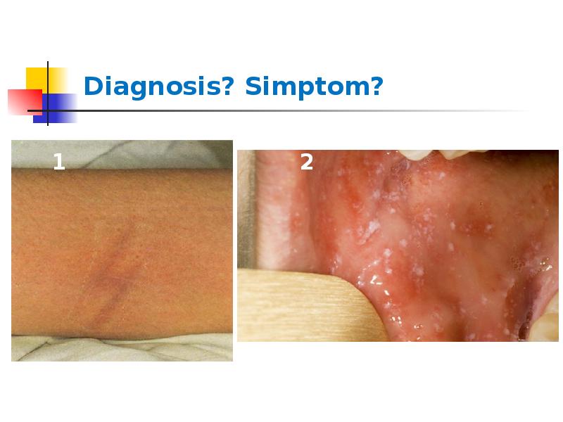 Diagnosis? Simptom? Diagnosis? Simptom?