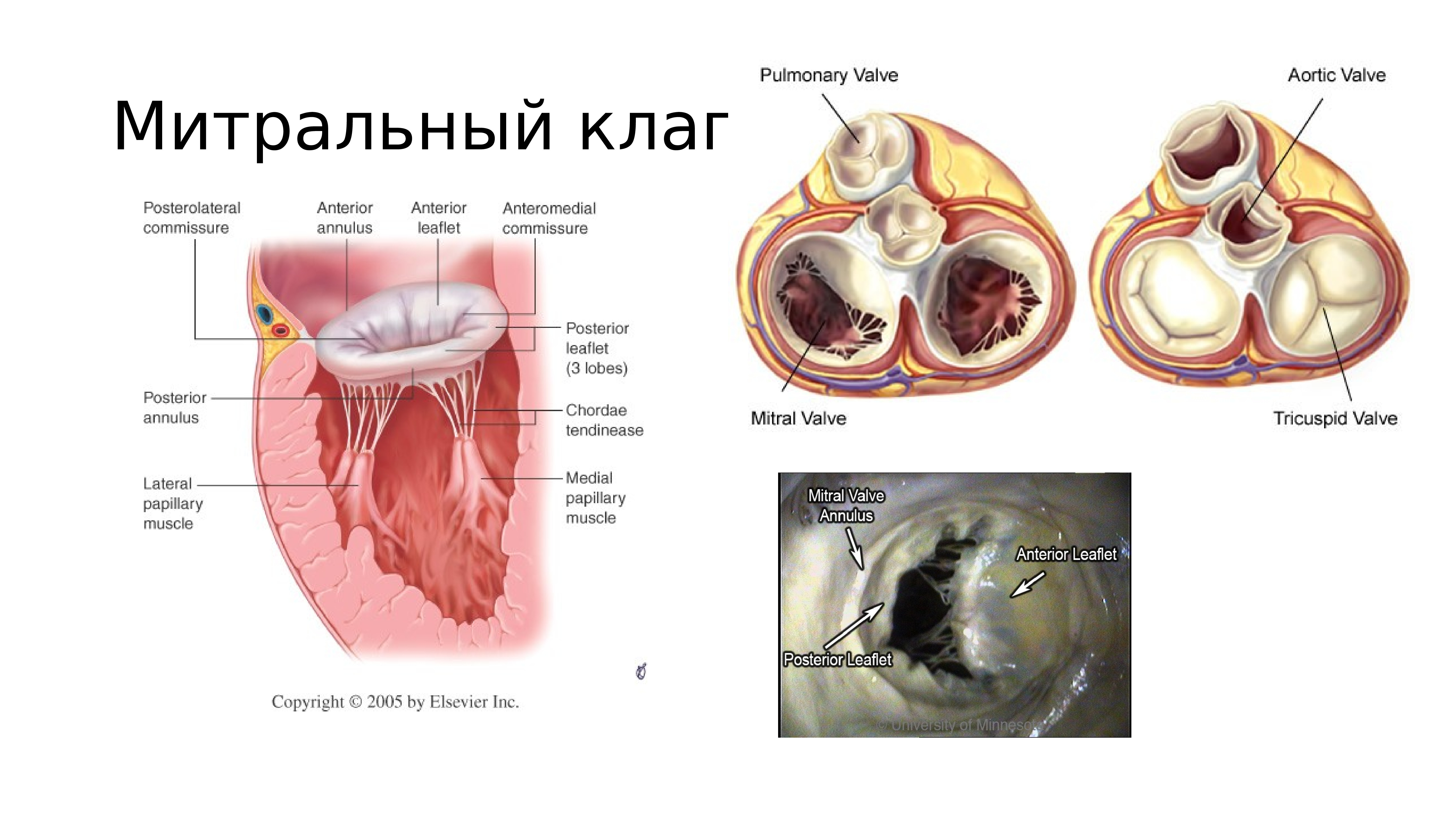 хорда сердца фото