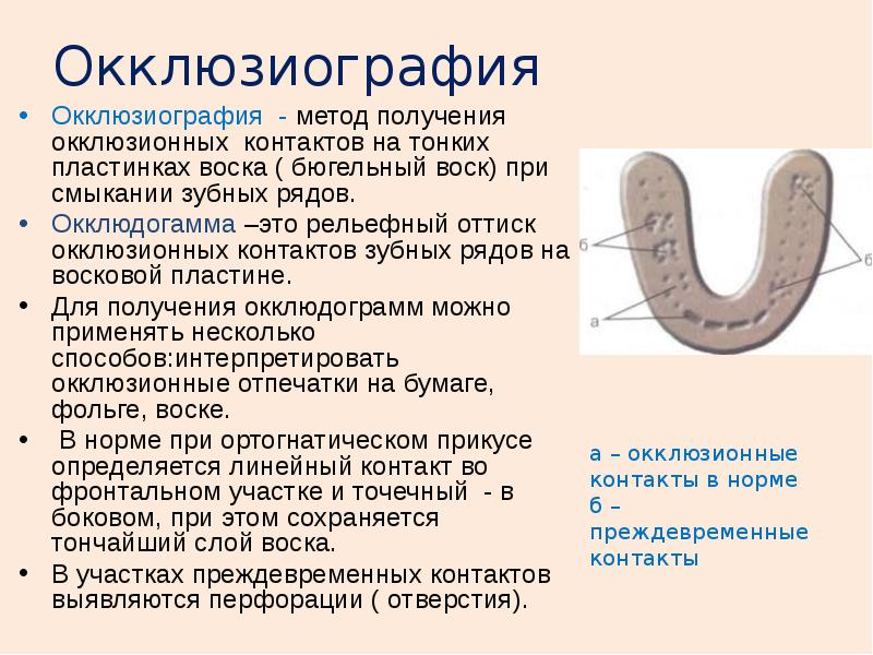 Генерализованный пародонтит презентация