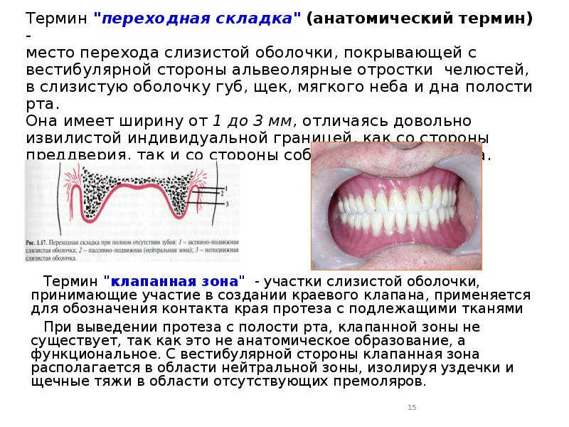 Переходная складка нижней челюсти