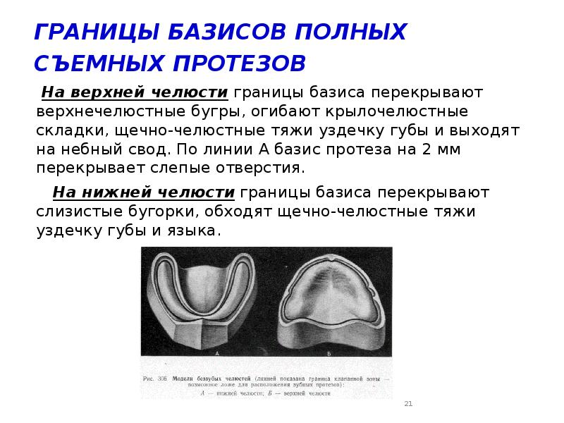 Границы частичного съемного протеза