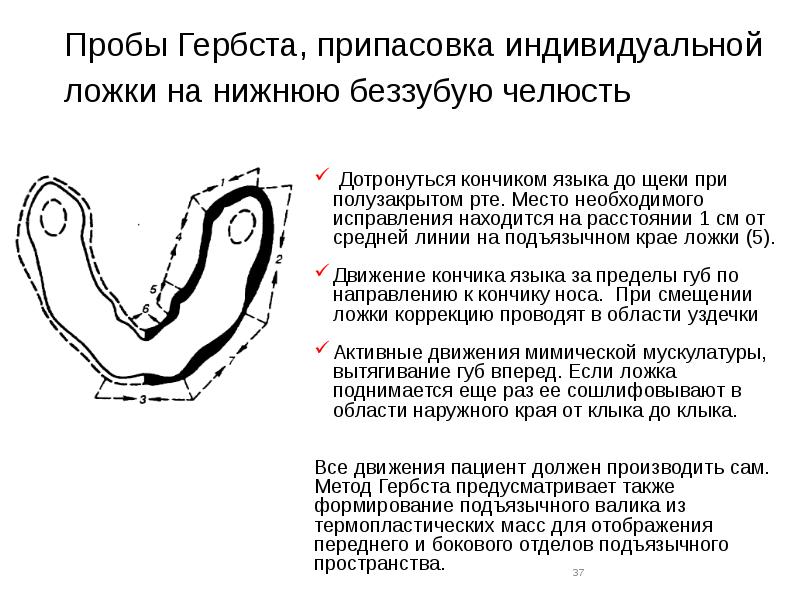 Припасовка индивидуальной ложки на верхней челюсти проводят по следующему плану