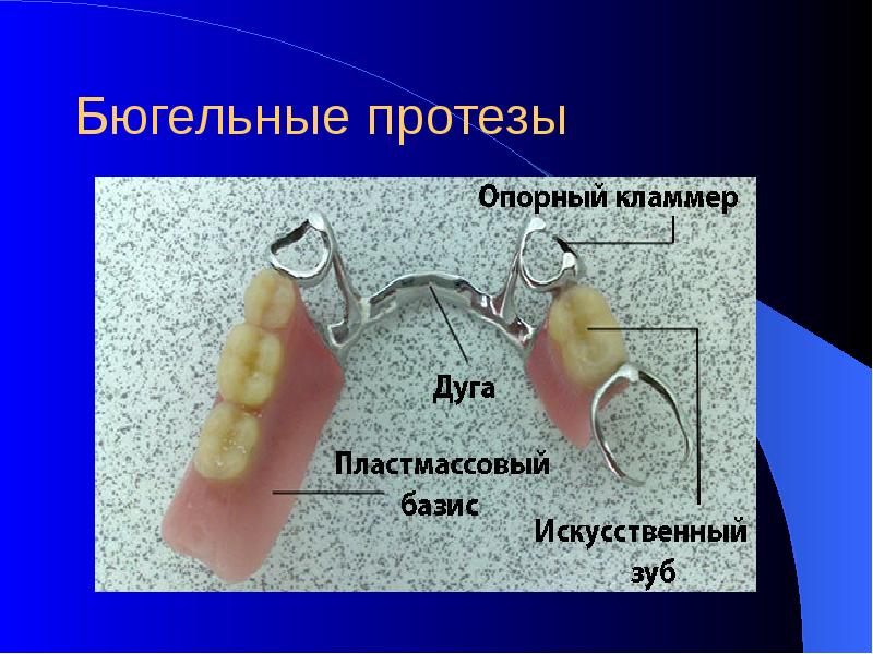 Съемные ортопедические конструкции презентация