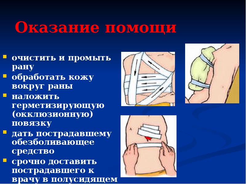 Первая помощь при ранах презентация