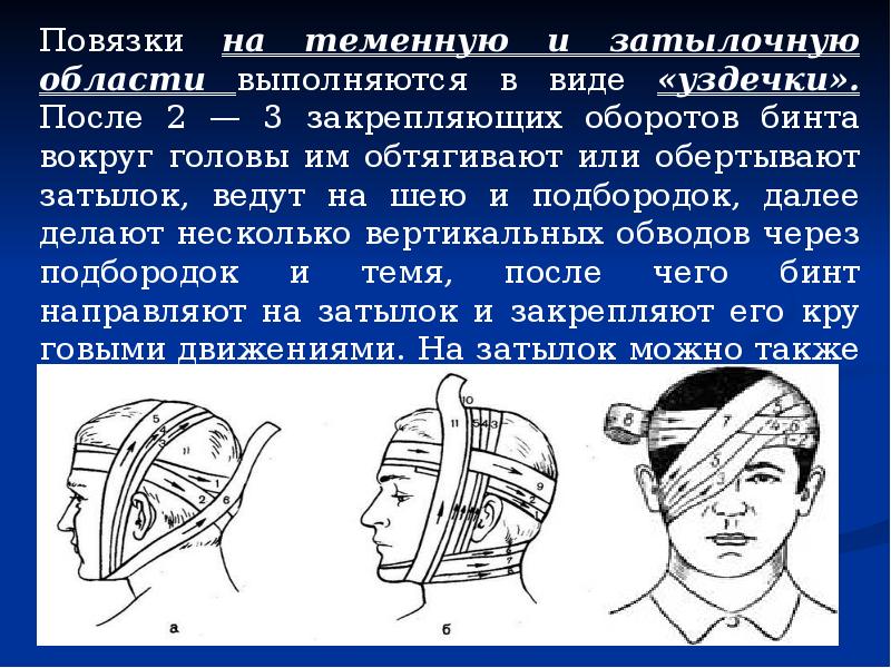 Какая повязка изображена на данном рисунке