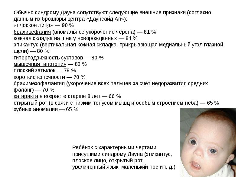 Генетические болезни новорожденных. Расширенный неонатальный скрининг. Скрининг новорожденных на наследственные заболевания. Фенилкетонурия это наследственное заболевание. Генетические болезни новорожденных.