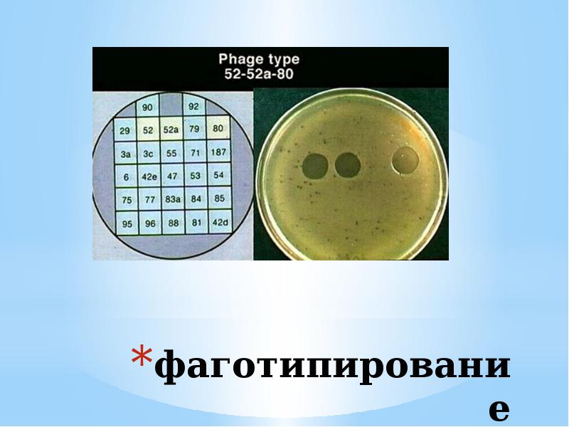 Фаготипирование это. Фаготипирование s.typhi. метод фаготипирования микробиология. фаготипирование бактериофагов. фаготипирование бактерий микробиология.