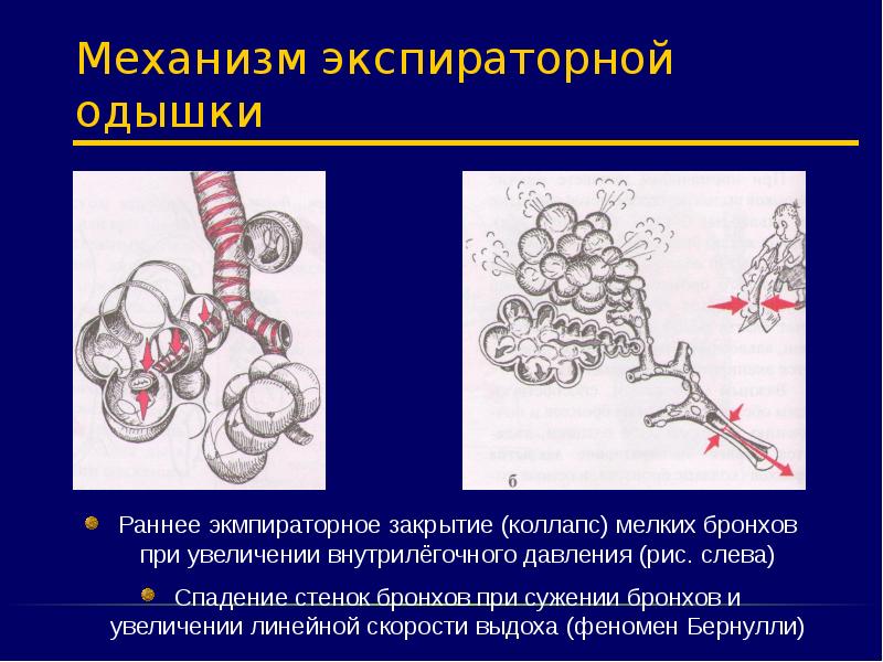 Виды одышки физиологическая и патологическая схема