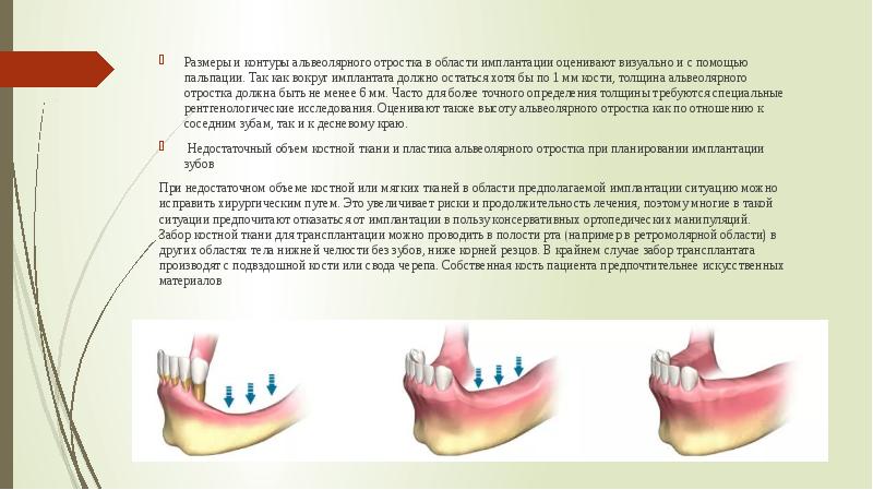 Показания и противопоказания к дентальной имплантации презентация