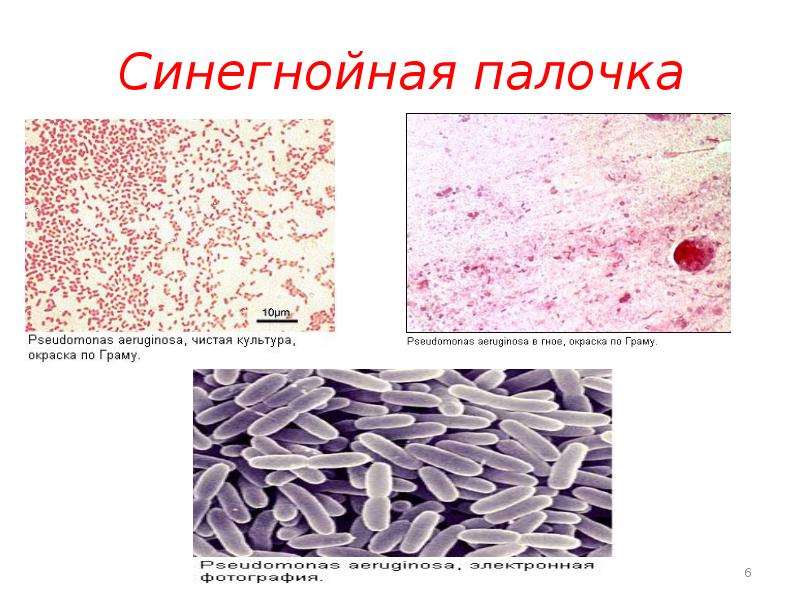 Синегнойная палочка презентация