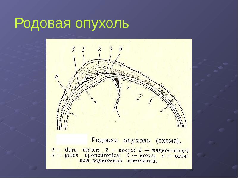 Картинки родовая опухоль