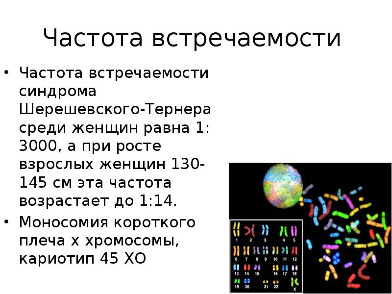 Синдром шерешевского тернера тельце барра