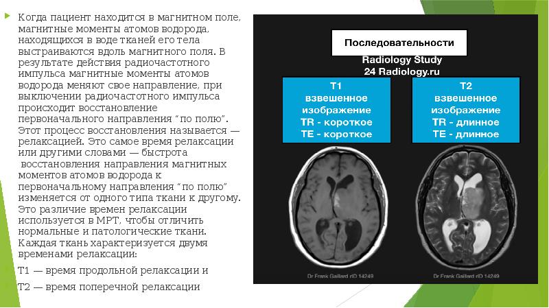 Режимы мрт презентация