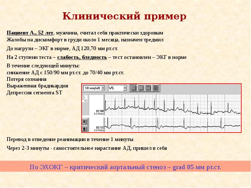 Тредмил тест презентация