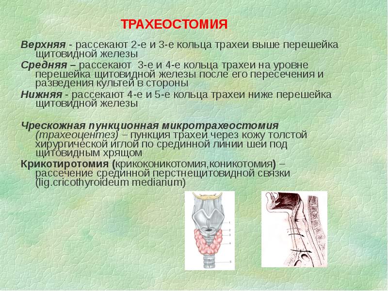 Операции на шее топографическая анатомия презентация