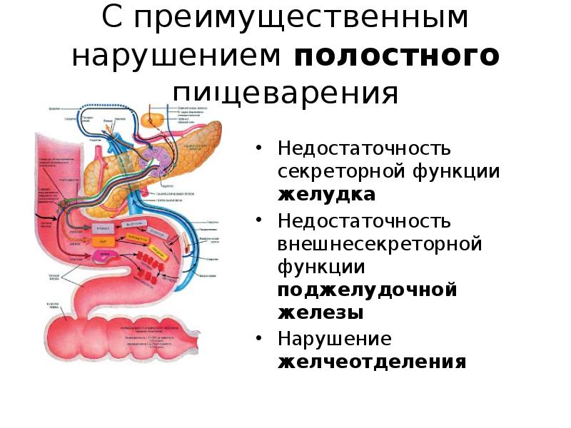 Полостное пищеварение. Нарушение полостного пищеварения. Недостаточность секреторной функции поджелудочной железы. Нарушение секреторной функции поджелудочной железы. Нарушение полостного пищеварения патофизиология.