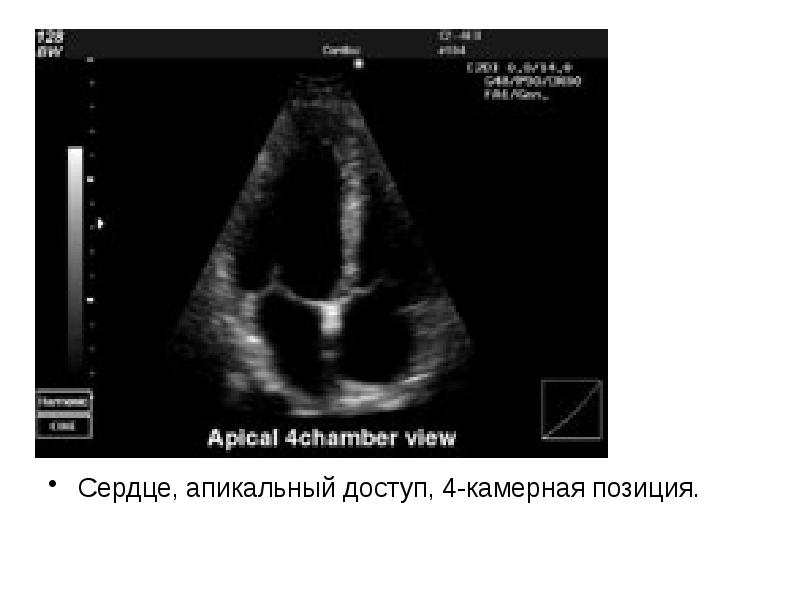 Презентация на тему узи сердца