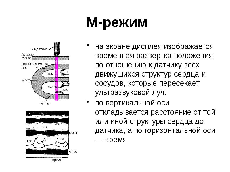 Принципы получения ультразвукового изображения сердца в трех режимах сканирования