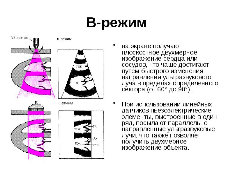 Принципы получения ультразвукового изображения сердца в трех режимах сканирования