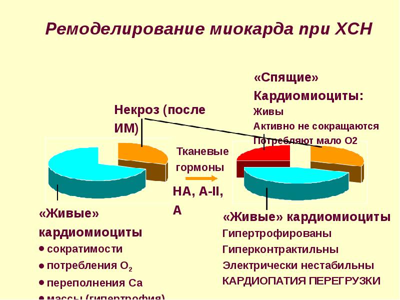 Концентрическое ремоделирование стенок лж