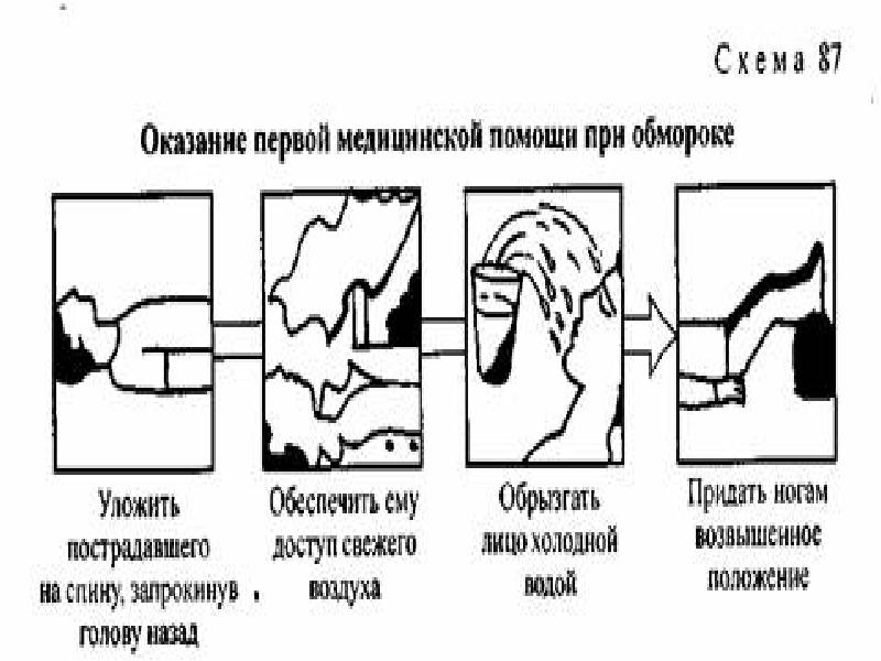 Схема действия в случаях обморока