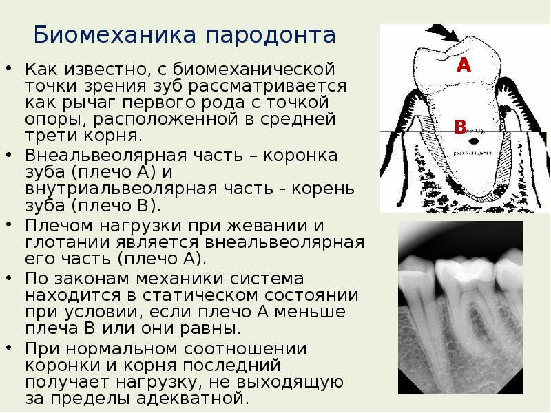 Этиология и патогенез заболеваний пародонта презентация