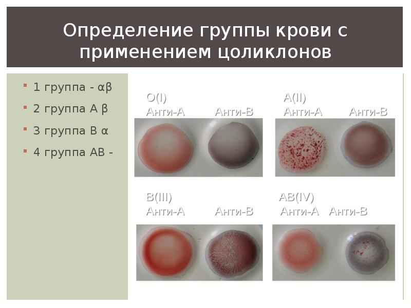 Определение группы крови и резус фактора цоликлонами алгоритм и картинки