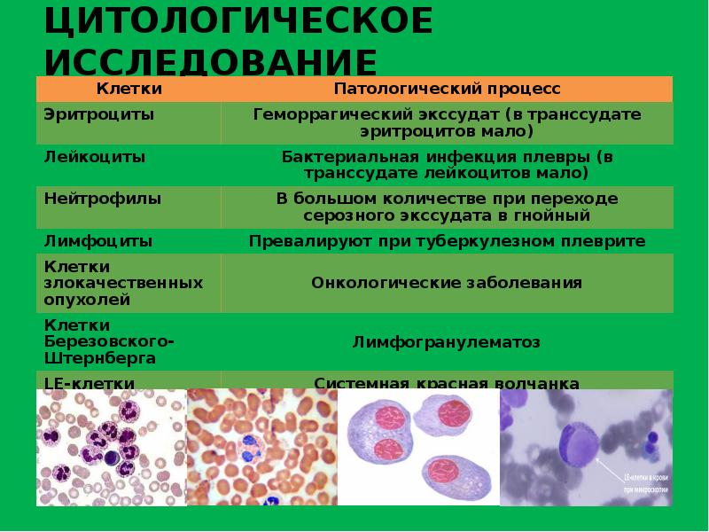 Анализы мокроты виды