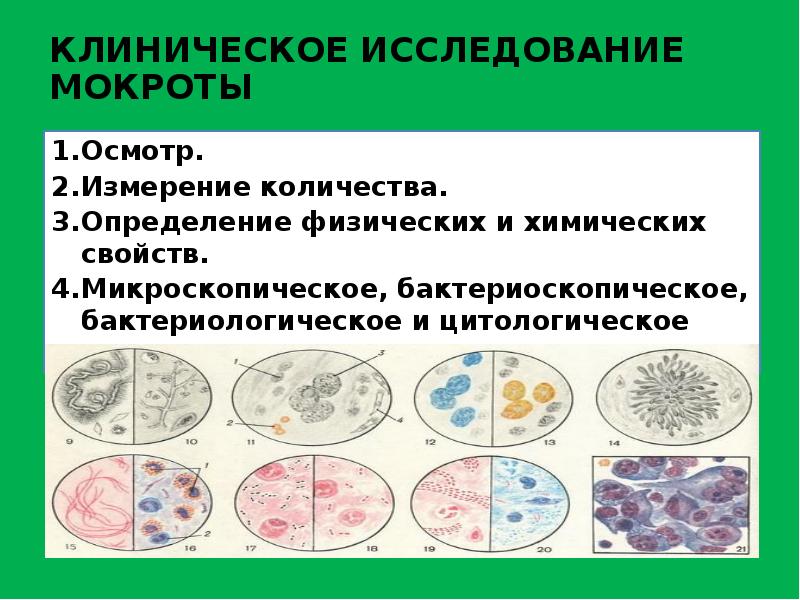 Микроскопическое исследование предстательной железы. Микроскопическое исследование мокроты. Клеточные элементы мокроты.