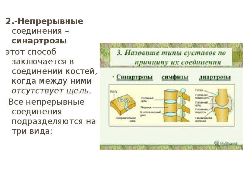 Классификация соединений костей виды непрерывных соединений. Непрерывные соединения синартрозы. синартроз соединение костей. непрерывные соединения костей. типы соединений костей синартрозы.