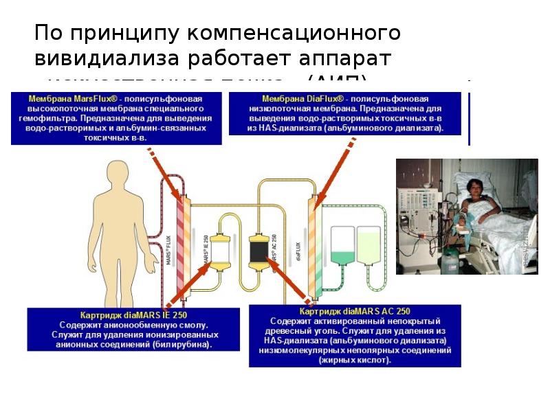 Принцип работы аппарата искусственная почка рисунок