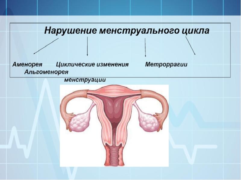 Гинекология нарушения цикла. Нарушение менструального цикла. Нарушение менструационного цикла .аменорея. Нарушение цикла месячных. Нарушение менструальной функции.