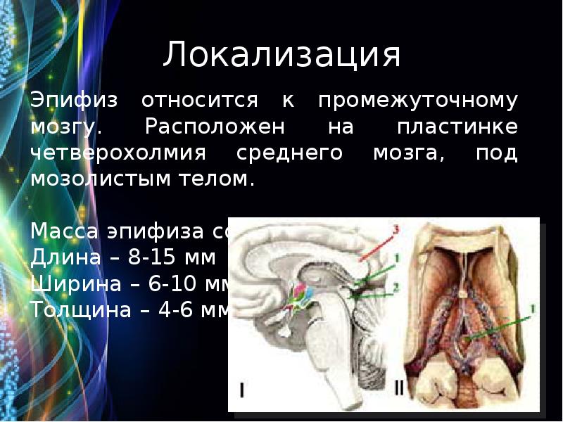 Мр картина кисты эпифиза что это