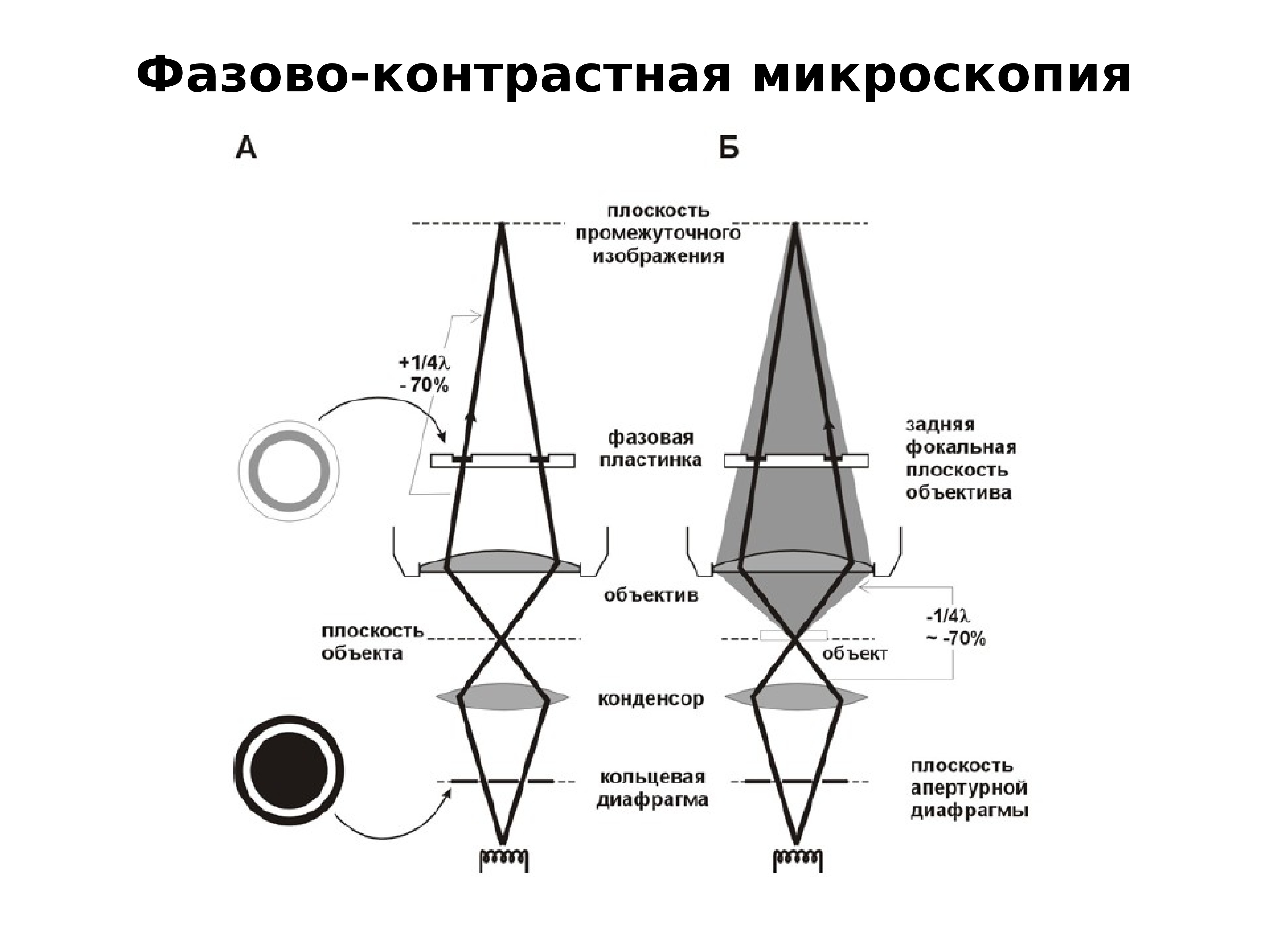 Фазово контрастная микроскопия. Фазово-контрастная микроскопия принцип. Фазово-контрастная микроскопия схема. Метод фазово-контрастной микроскопии. Фазово-контрастная микроскопия микробиология.